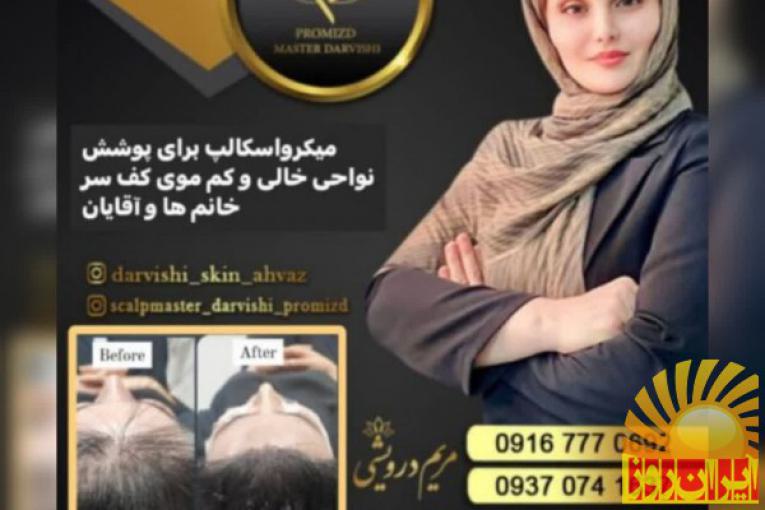 میکرواسکالپ سر